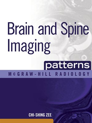 cover image of Brain and Spine Imaging Patterns